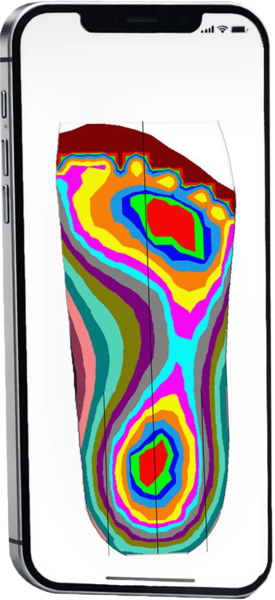 Amfit Scan app showing a plantar scan on an iPhone