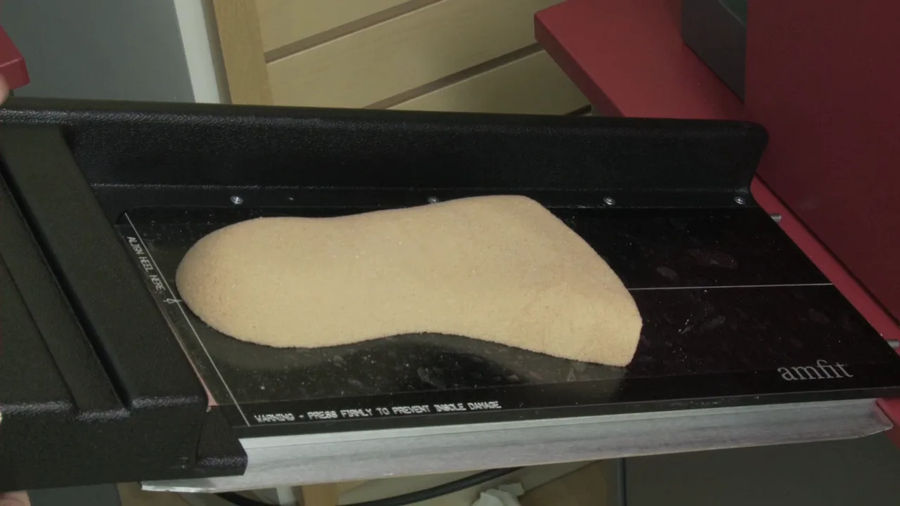 Why Orthotic Remakes Happen and How to Reduce Them