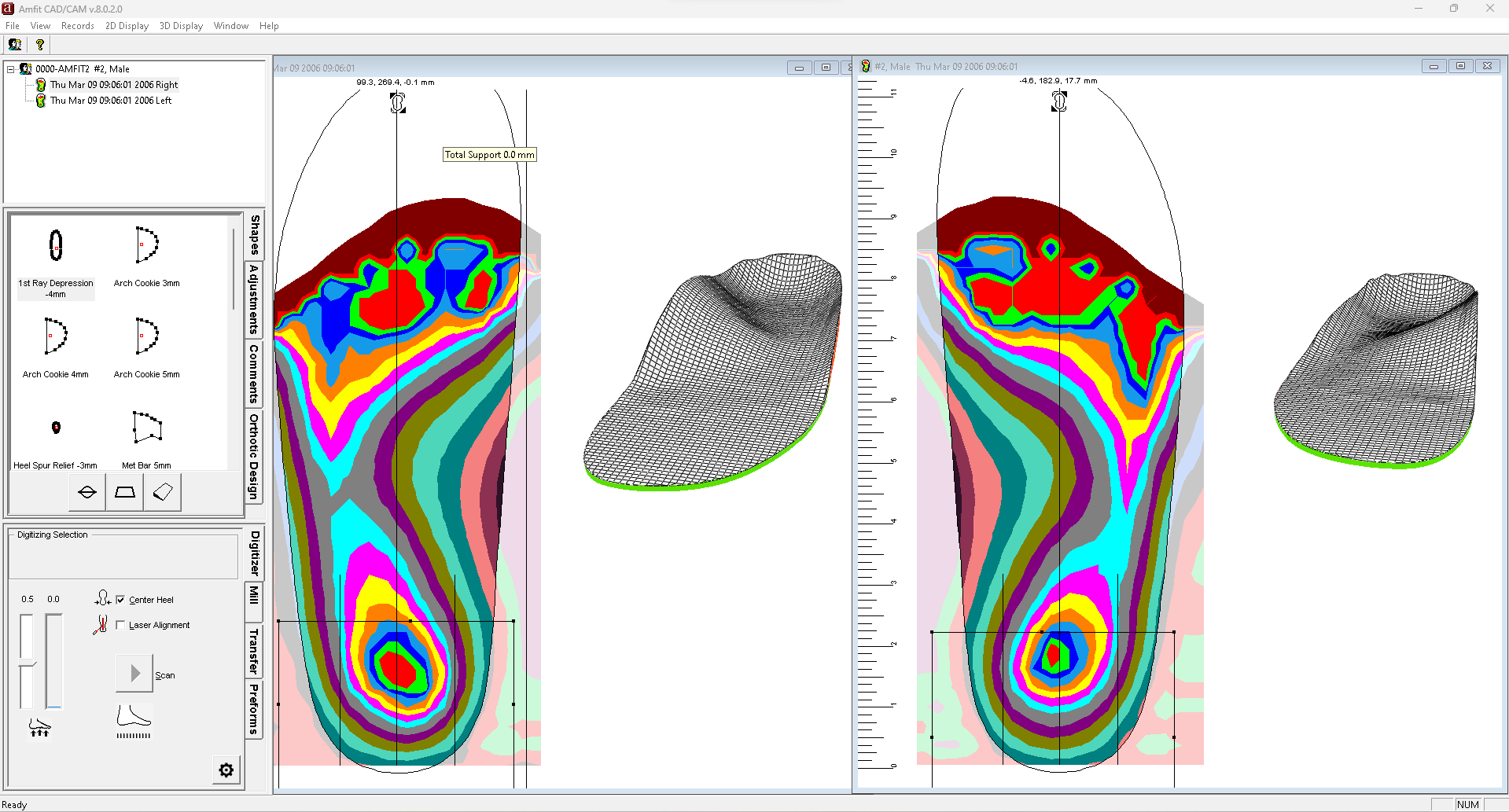 Correct & Confirm orthotic editing software