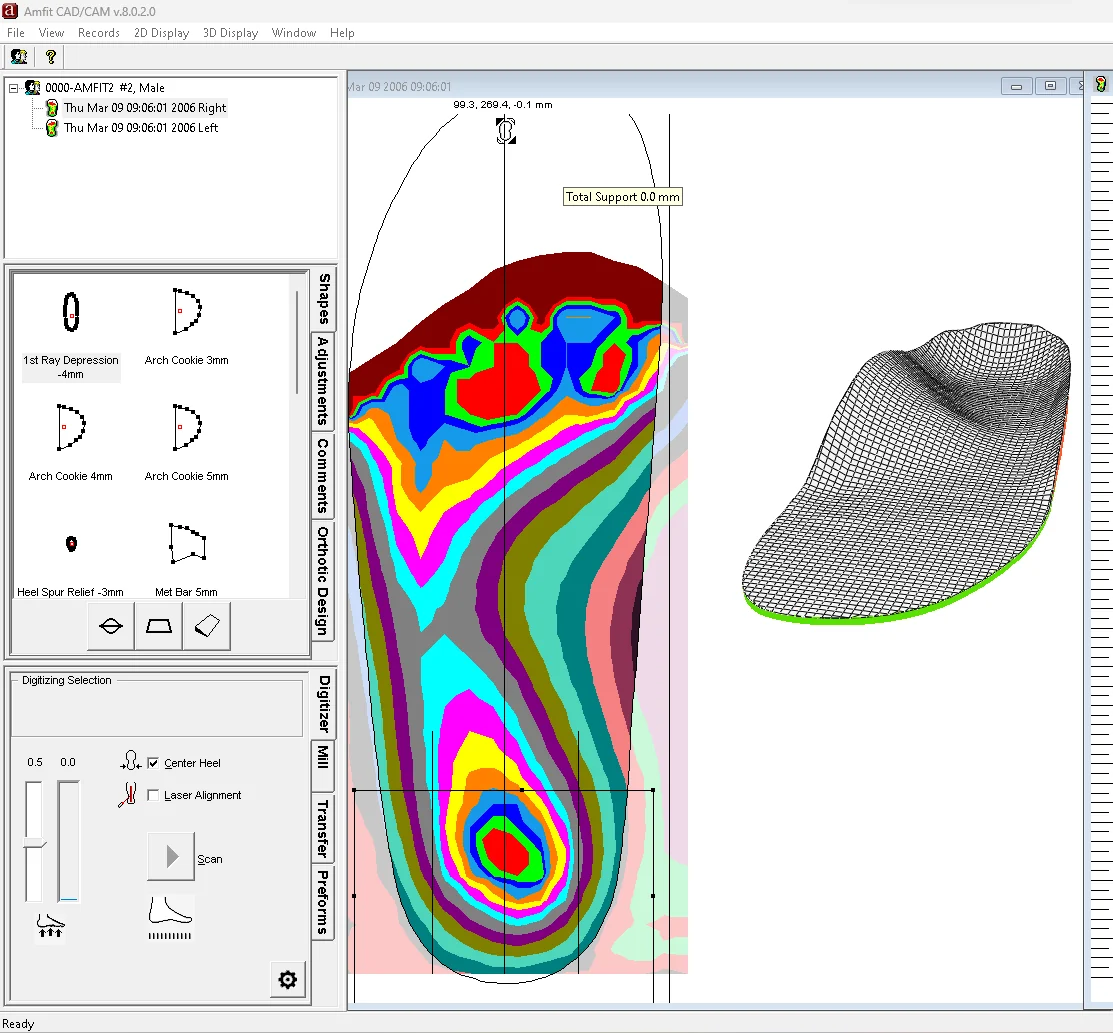 Correct & Confirm software showing a foot scan record and 3D orthotic preview
